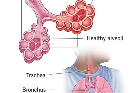 Pneumonitis