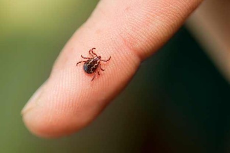 Babesiosis