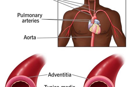 Elastic Arteries