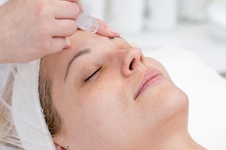 Microdermabrasion