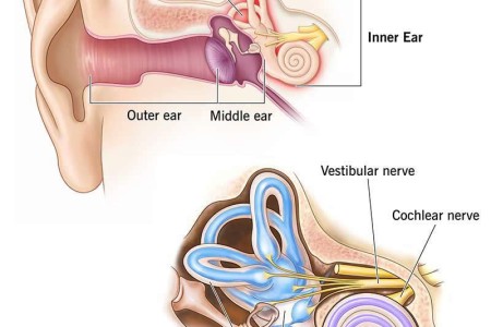 Inner Ear Infection (Otitis Interna)