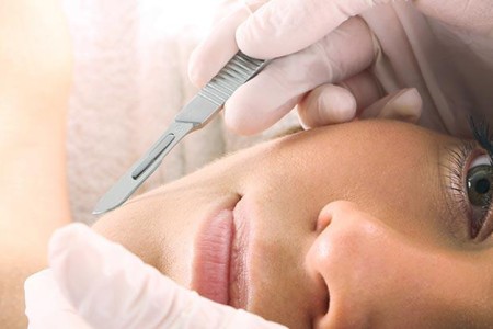 Dermaplaning