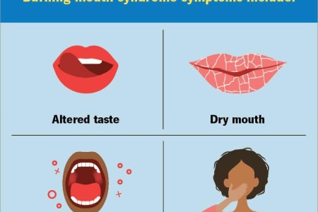 Burning Mouth Syndrome