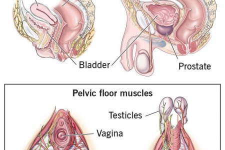 Pelvic Floor Dysfunction