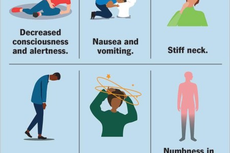 Subarachnoid Hemorrhage (SAH)