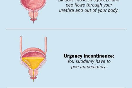 Urge Incontinence
