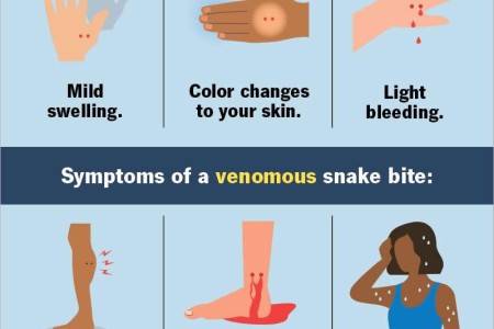 Snake Bites