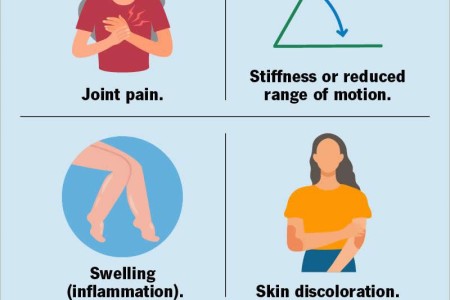 Arthritis