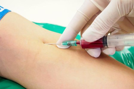 Anion Gap Blood Test