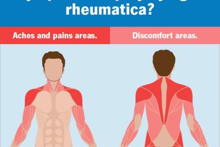 Polymyalgia Rheumatica