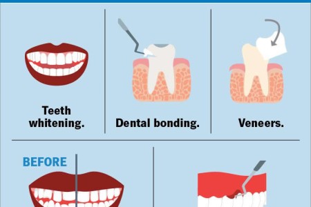 Cosmetic Dentistry