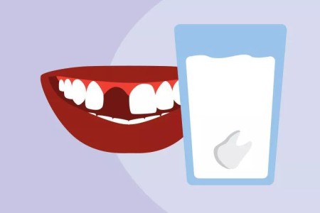 What To Do When You Knock Out a Tooth