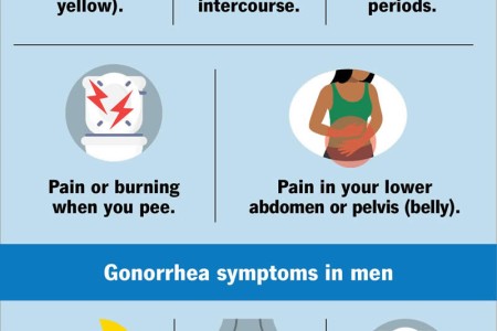 Gonorrhea