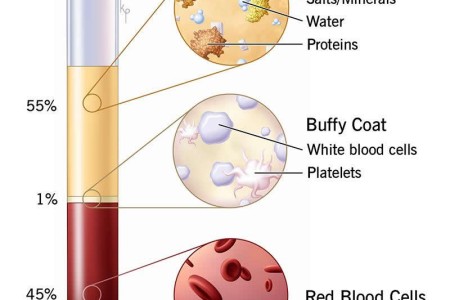 Plasma