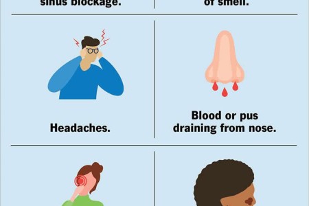 Nasal and Paranasal Tumors