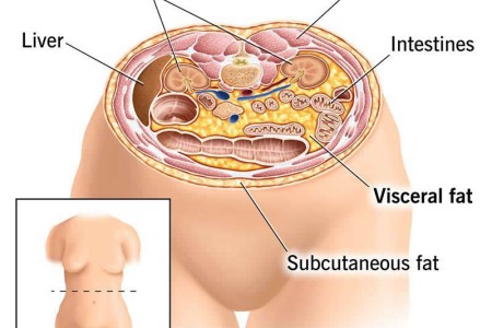 Visceral Fat