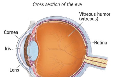 Vitrectomy