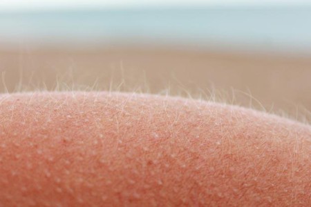Vellus Hair (Peach Fuzz)