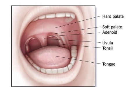 Adenoidectomy (Adenoid Removal)