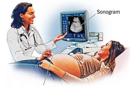 Abdominal Ultrasound