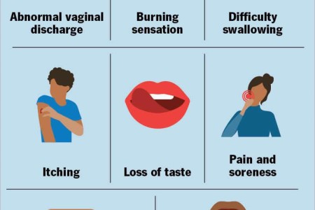 Candidiasis