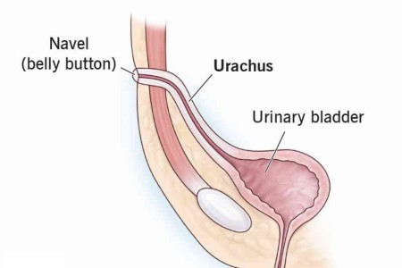 Urachus