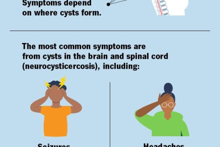 Cysticercosis
