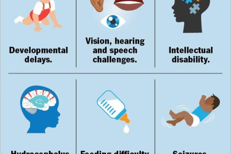 Agenesis of the Corpus Callosum (ACC)