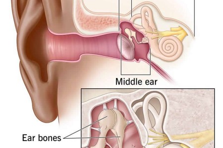 Ear Infection (Otitis Media)