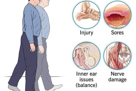 Gait Disorders and Abnormalities