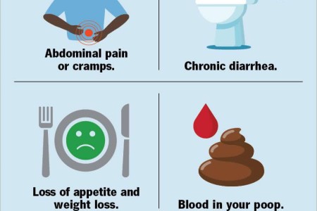Crohn's Disease