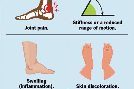Foot and Ankle Arthritis