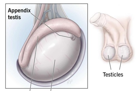 Appendix Testis (Hydatid of Morgagni)