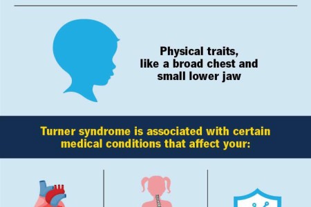 Turner Syndrome
