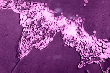 Candida Albicans