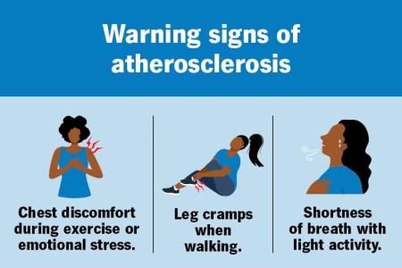 Atherosclerosis