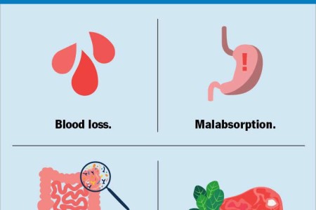 Iron-Deficiency Anemia