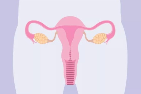 Getting Pregnant With PCOS