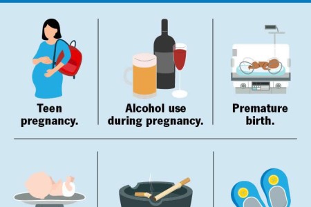 SIDS (Sudden Infant Death Syndrome)