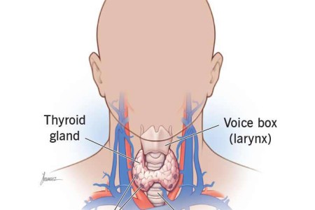 Parathyroidectomy (Parathyroid Surgery)