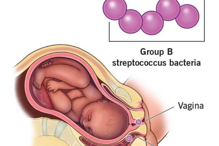 Group B Strep Pregnancy