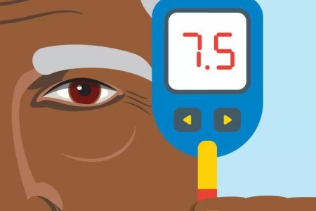 Diabetes-Related Macular Edema: Answers to Your Most Common Questions