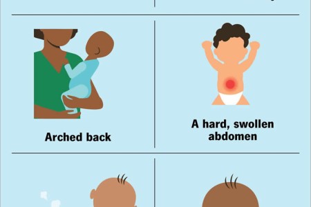 Colic