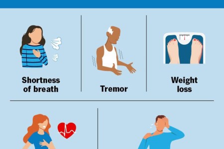 Graves’ Disease