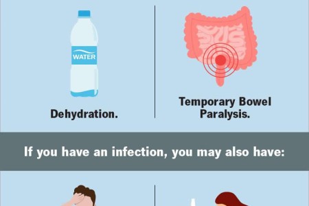 Peritonitis