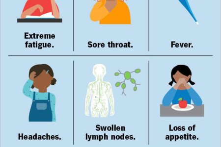Mononucleosis
