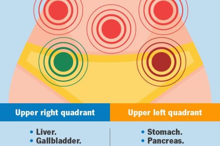 Abdominal Pain