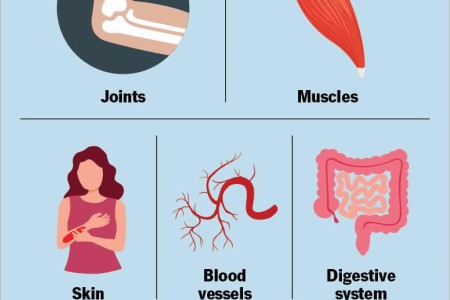 Autoimmune Diseases