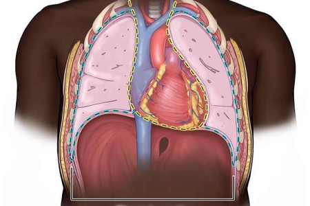 Mediastinum
