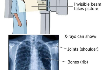 X-Ray